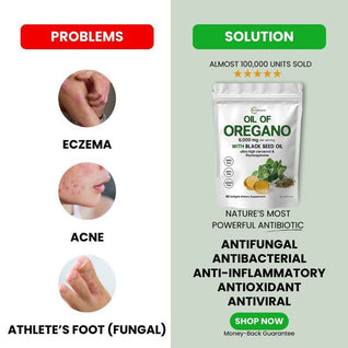 Oil of Oregano - Nature’s Ultimate Defense Premium Product That Solves Your Digestion, Heart, Weight & Detoxify