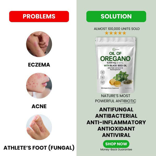 Oil of Oregano - Nature’s Ultimate Defense Premium Product That Solves Your Digestion, Heart, Weight & Detoxify